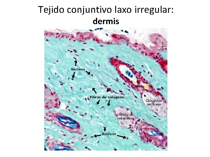 Tejido conjuntivo laxo irregular: dermis 