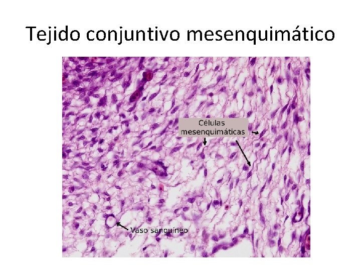 Tejido conjuntivo mesenquimático 