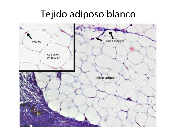 Tejido adiposo blanco 