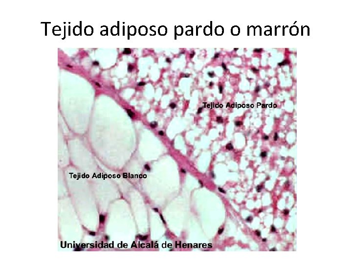 Tejido adiposo pardo o marrón 