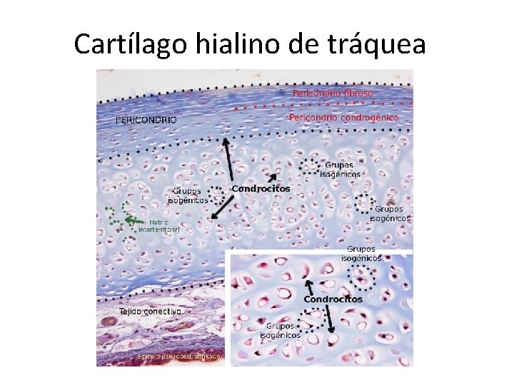 Cartílago hialino de tráquea 