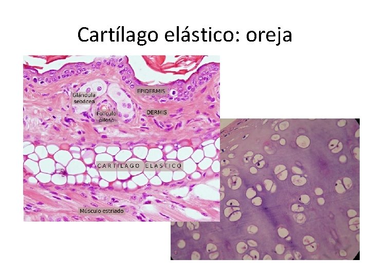Cartílago elástico: oreja 