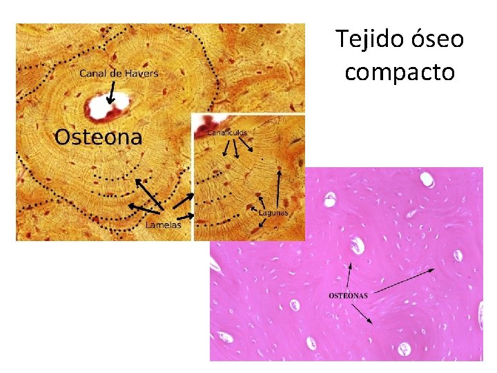 Tejido óseo compacto 