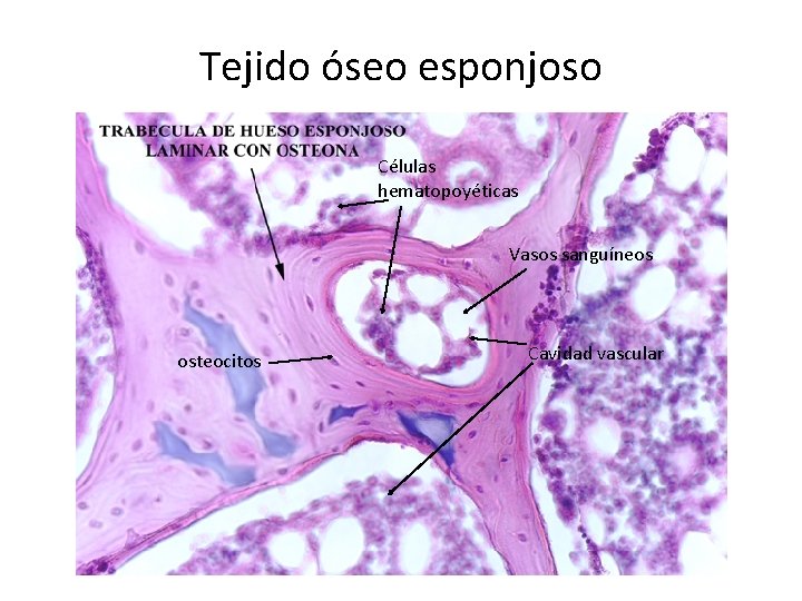 Tejido óseo esponjoso Células hematopoyéticas Vasos sanguíneos osteocitos Cavidad vascular 