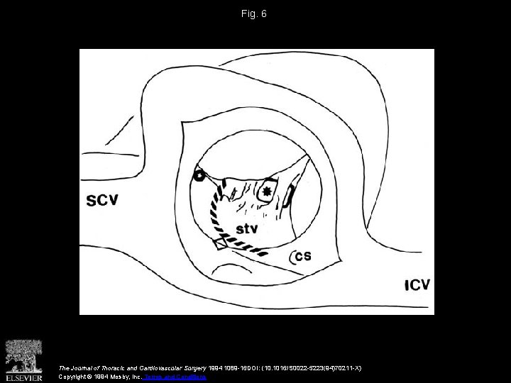 Fig. 6 The Journal of Thoracic and Cardiovascular Surgery 1994 1089 -16 DOI: (10.