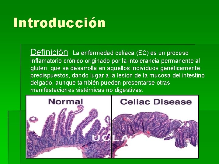 Introducción Definición: La enfermedad celíaca (EC) es un proceso inflamatorio crónico originado por la