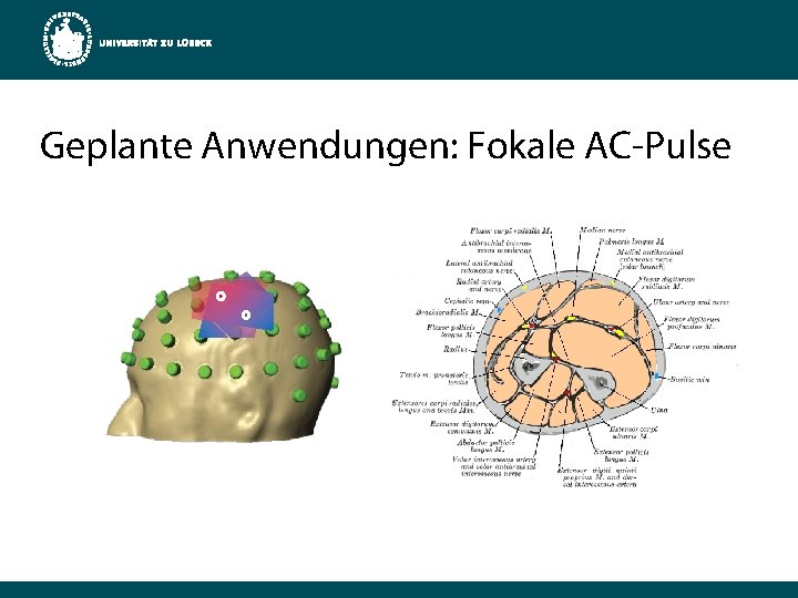 Geplante Anwendungen: Fokale AC-Pulse 