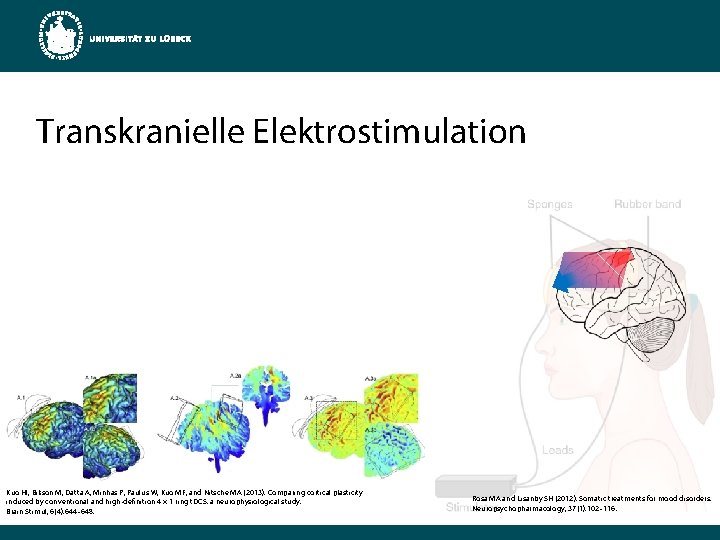 Transkranielle Elektrostimulation Kuo HI, Bikson M, Datta A, Minhas P, Paulus W, Kuo MF,