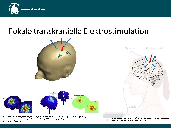 Fokale transkranielle Elektrostimulation Kuo HI, Bikson M, Datta A, Minhas P, Paulus W, Kuo
