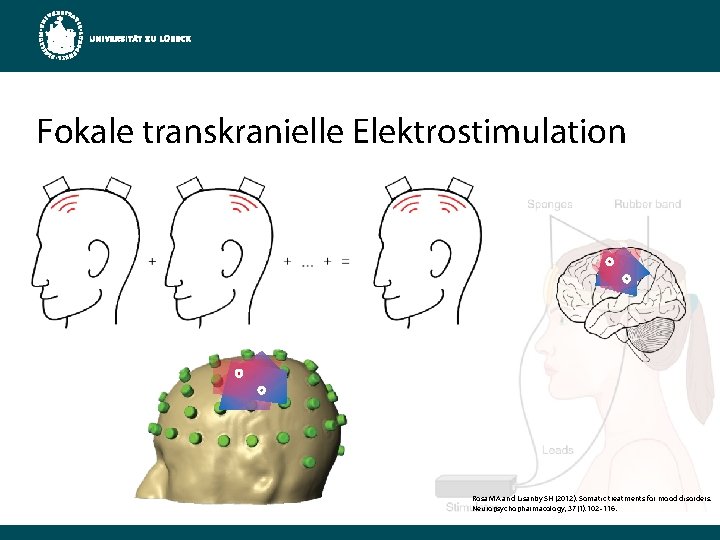 Fokale transkranielle Elektrostimulation Rosa MA and Lisanby SH (2012). Somatic treatments for mood disorders.