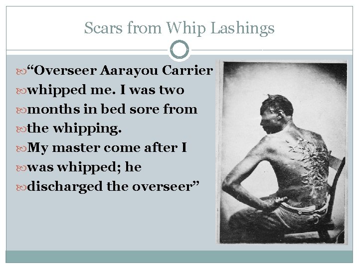 Scars from Whip Lashings “Overseer Aarayou Carrier whipped me. I was two months in