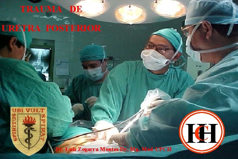 TRAUMA DE URETRA POSTERIOR Dr. Luis Zegarra Montes Dr. Mg. -Med-UPCH HCH 