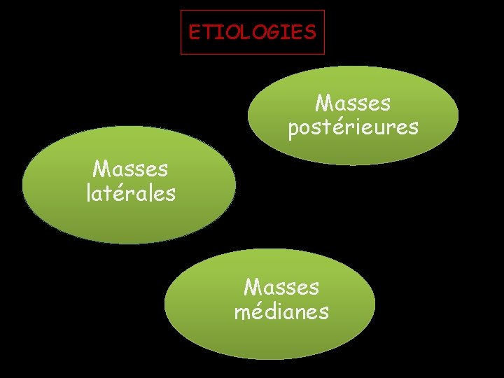 ETIOLOGIES Masses postérieures Masses latérales Masses médianes ETIOLOGIES Masses postérieures Masses latérales Masses médianes