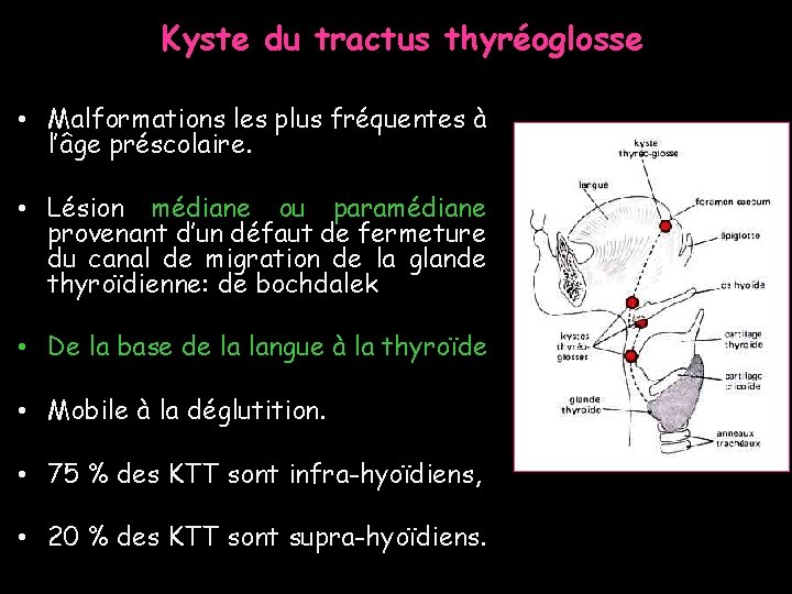 Kyste du tractus thyréoglosse • Malformations les plus fréquentes à l’âge préscolaire. • Lésion Kyste du tractus thyréoglosse • Malformations les plus fréquentes à l’âge préscolaire. • Lésion