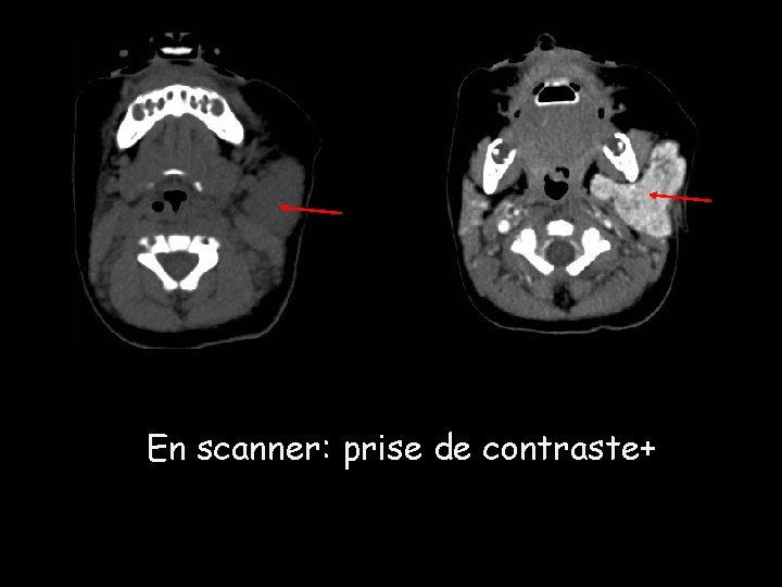 En scanner: prise de contraste+ En scanner: prise de contraste+