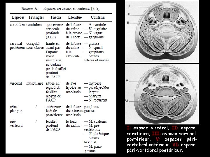 I: espace viscéral, II: espace carotidien, III: espace cervical postérieur, V: espaces périvertébral antérieur, I: espace viscéral, II: espace carotidien, III: espace cervical postérieur, V: espaces périvertébral antérieur,
