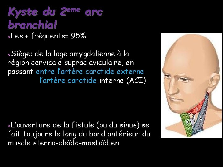 Kyste du 2 eme arc branchial Les + fréquents= 95% v Siège: de la Kyste du 2 eme arc branchial Les + fréquents= 95% v Siège: de la