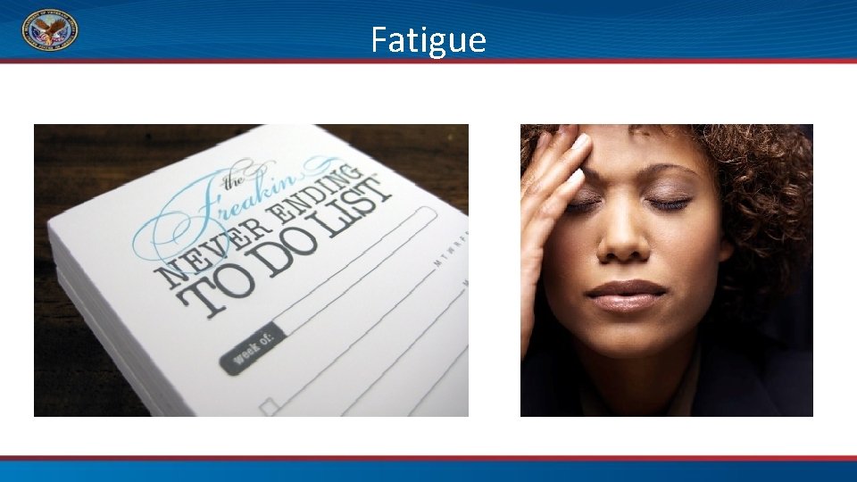 Fatigue 