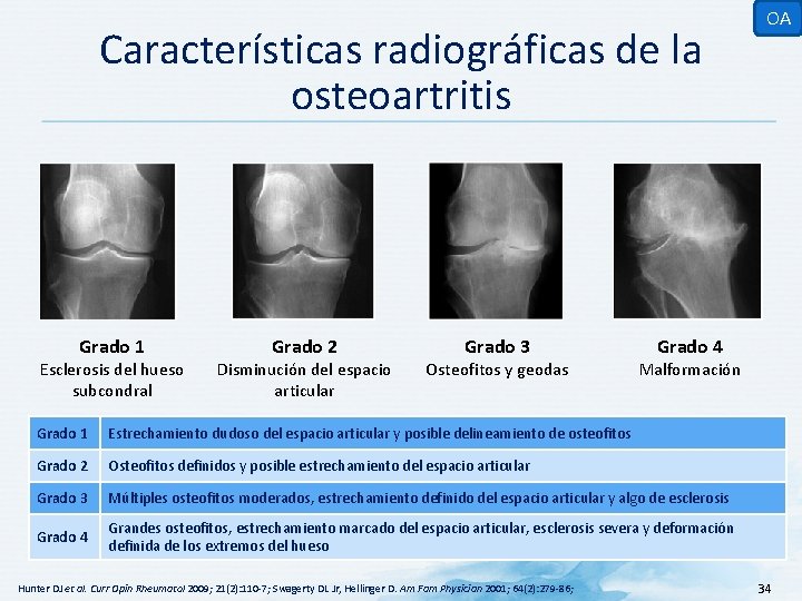 Características radiográficas de la osteoartritis Grado 1 Esclerosis del hueso subcondral Grado 2 Disminución