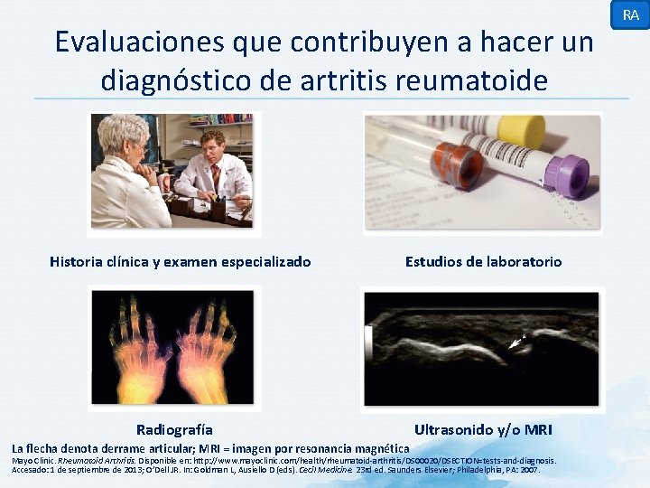 Evaluaciones que contribuyen a hacer un diagnóstico de artritis reumatoide Historia clínica y examen