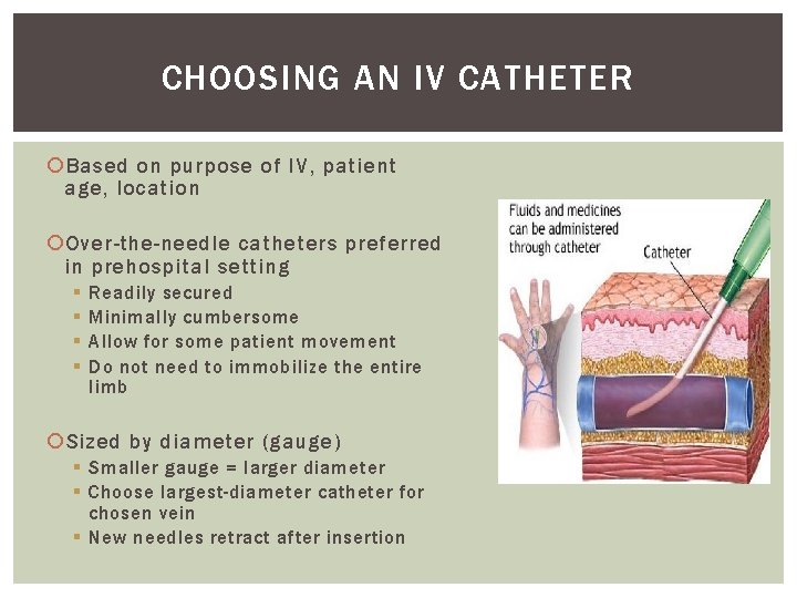 CHOOSING AN IV CATHETER Based on purpose of IV, patient age, location Over-the-needle catheters