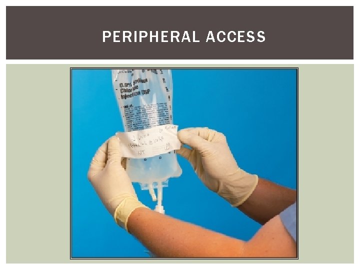 PERIPHERAL ACCESS 