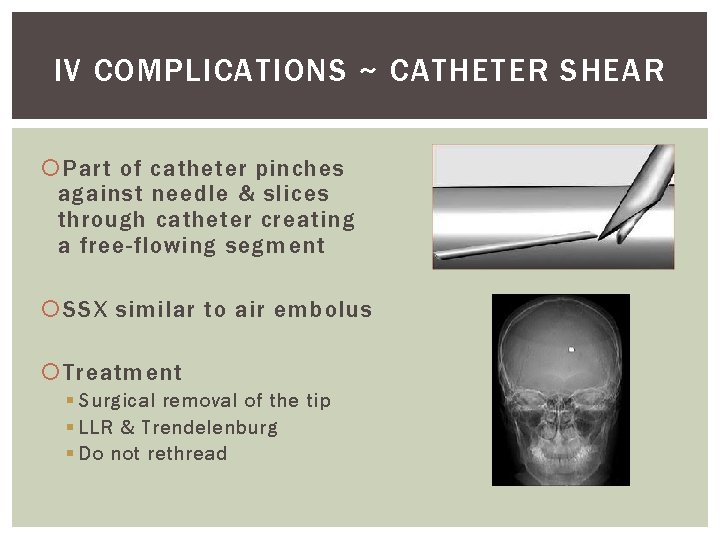 IV COMPLICATIONS ~ CATHETER SHEAR Part of catheter pinches against needle & slices through