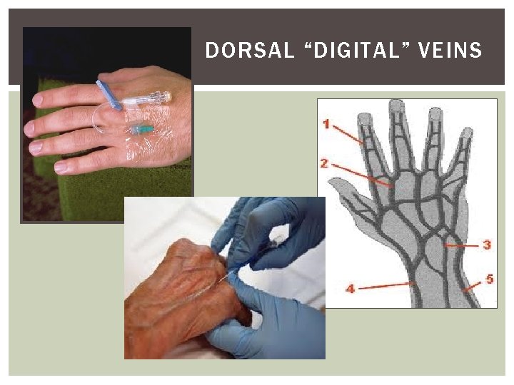 DORSAL “DIGITAL” VEINS 