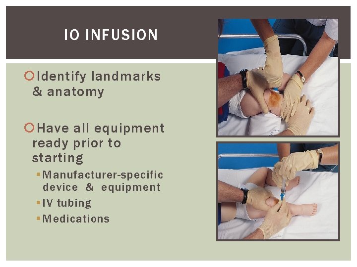 IO INFUSION Identify landmarks & anatomy Have all equipment ready prior to starting §