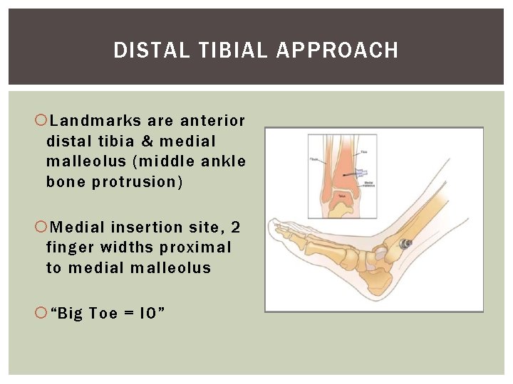 DISTAL TIBIAL APPROACH Landmarks are anterior distal tibia & medial malleolus (middle ankle bone