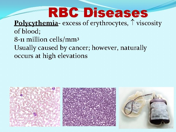 Excessive Rbc Breakdown Blood is a fluid connective tissue constituting about