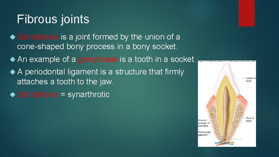 Fibrous joints Gomphosis is a joint formed by the union of a cone-shaped bony