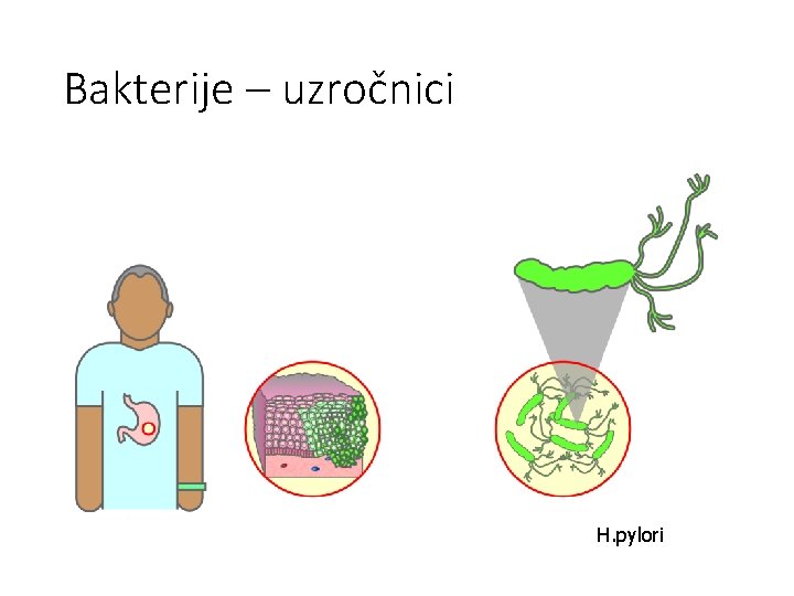 Bakterije – uzročnici H. pylori 