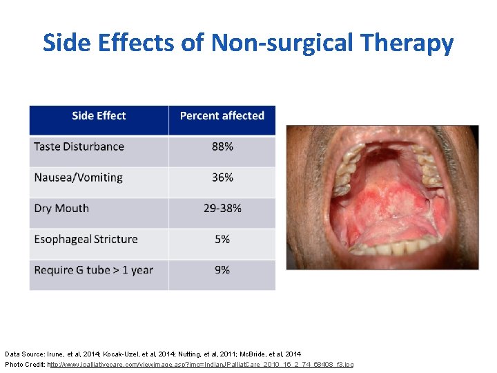 Side Effects of Non-surgical Therapy Data Source: Irune, et al, 2014; Kocak-Uzel, et al,