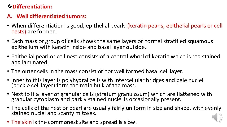v. Differentiation: A. Well differentiated tumors: • When differentiation is good, epithelial pearls (keratin