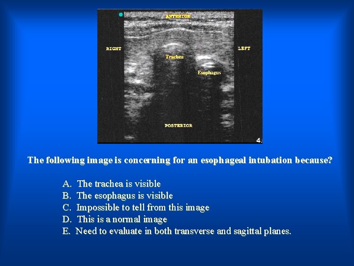 The following image is concerning for an esophageal intubation because? A. B. C. D.