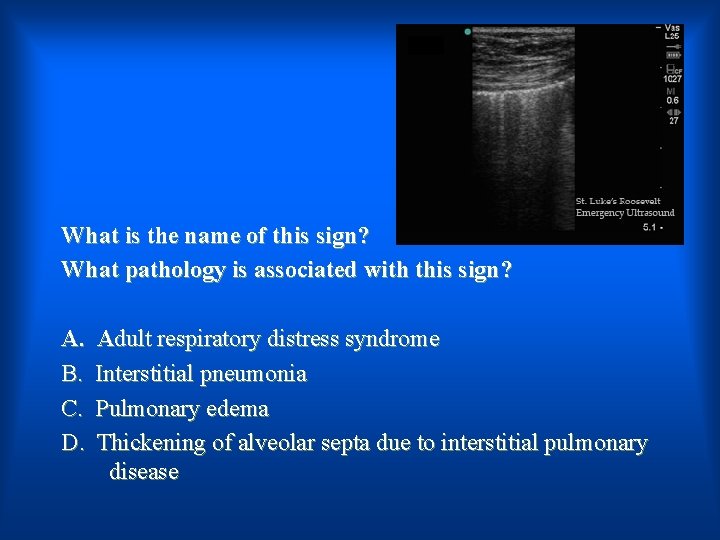 What is the name of this sign? What pathology is associated with this sign?