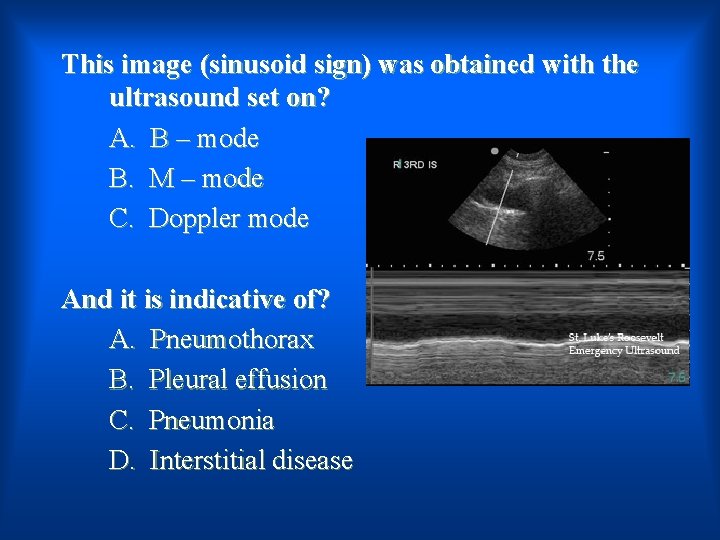 This image (sinusoid sign) was obtained with the ultrasound set on? A. B –