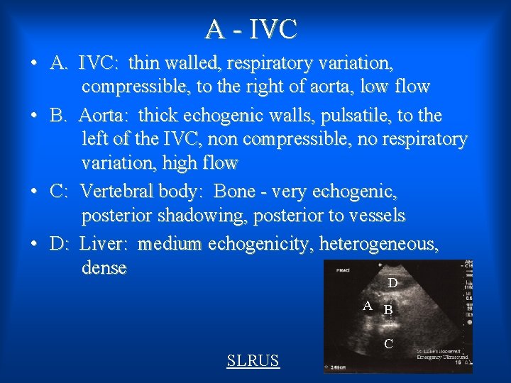 A - IVC • A. IVC: thin walled, respiratory variation, compressible, to the right