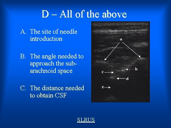 D – All of the above A. The site of needle introduction B. The