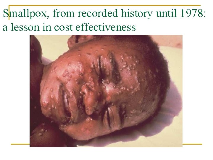 Smallpox, from recorded history until 1978: a lesson in cost effectiveness 