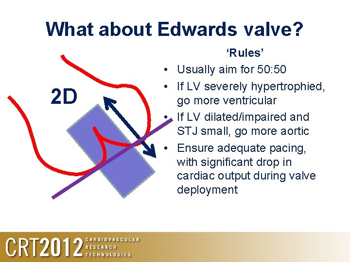 What about Edwards valve? 2 D • • ‘Rules’ Usually aim for 50: 50