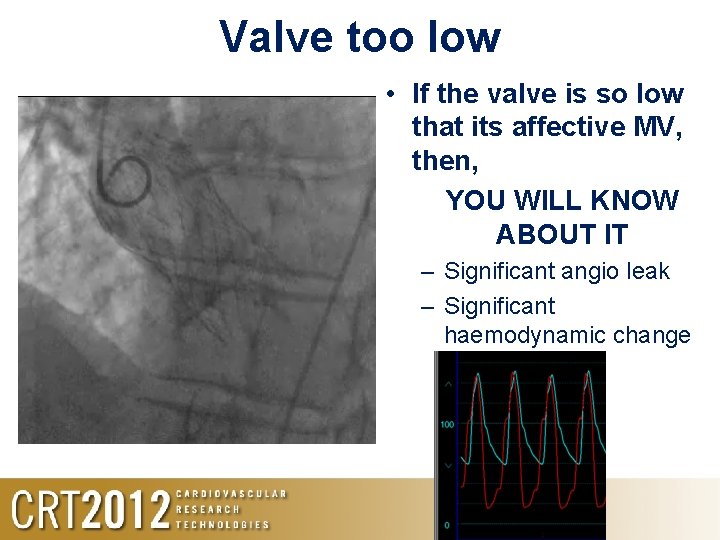 Valve too low • If the valve is so low that its affective MV,