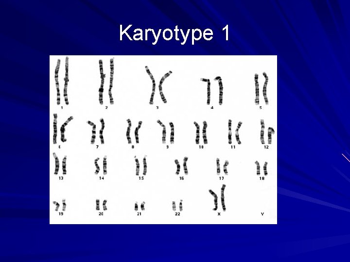 Karyotype 1 Karyotype 1