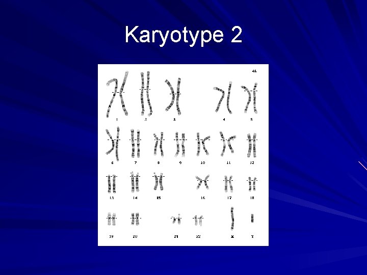 Karyotype 2 Karyotype 2
