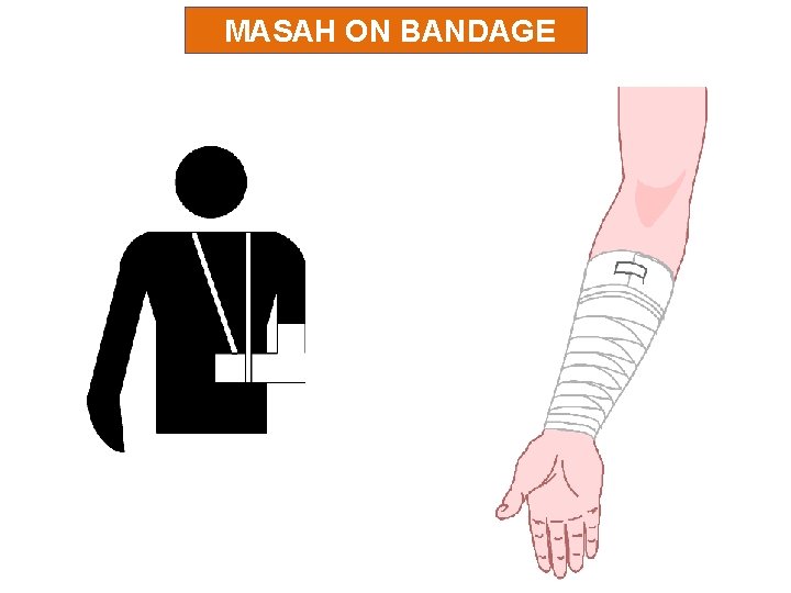 MASAH ON BANDAGE 