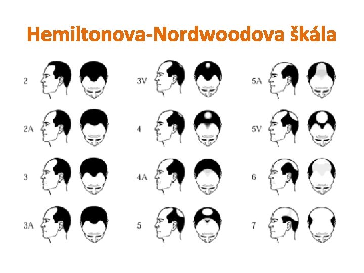 Hemiltonova-Nordwoodova škála 