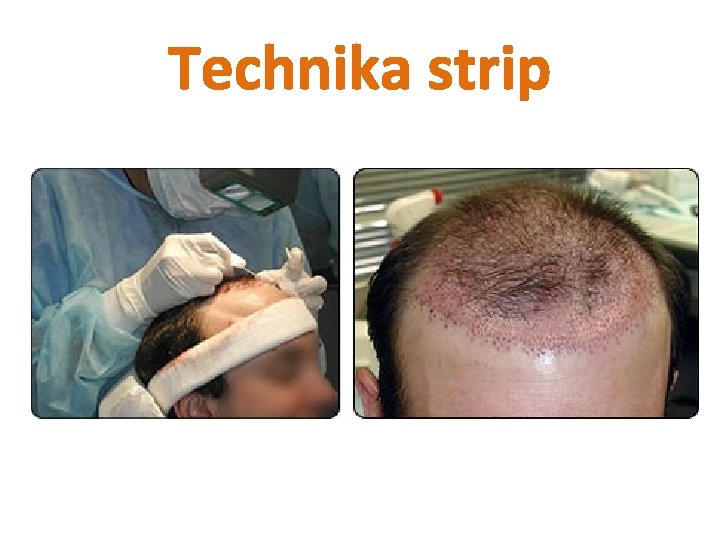 Technika strip 