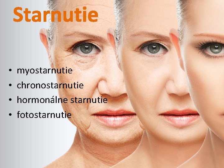 Starnutie • • myostarnutie chronostarnutie hormonálne starnutie fotostarnutie 
