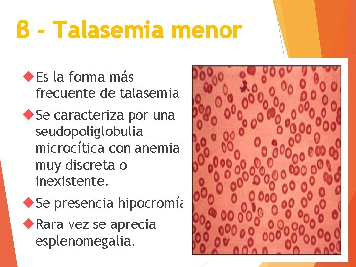 β - Talasemia menor Es la forma más frecuente de talasemia Se caracteriza por